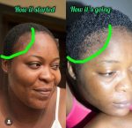 Hair Loss Combo - Image 2